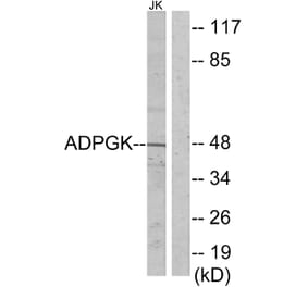 Western Blot - Anti-ADPGK Antibody (C11602) - Antibodies.com