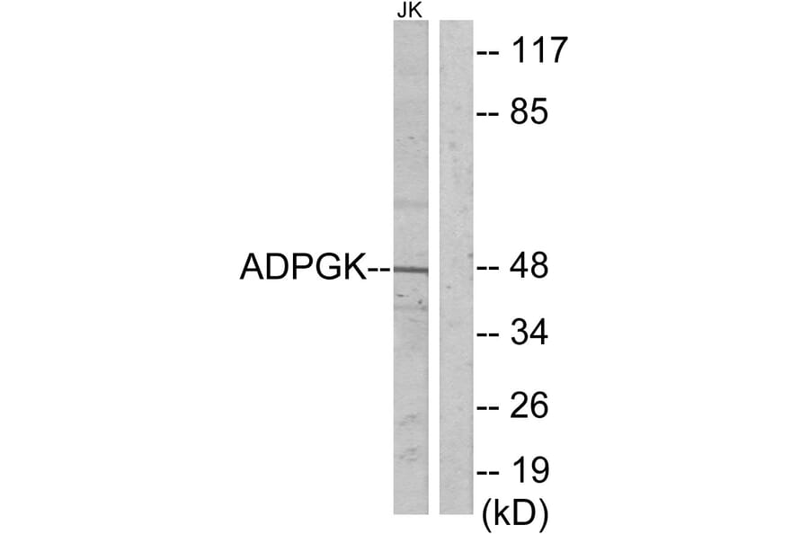 Western Blot - Anti-ADPGK Antibody (C11602) - Antibodies.com