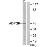 Western Blot - Anti-ADPGK Antibody (C11602) - Antibodies.com