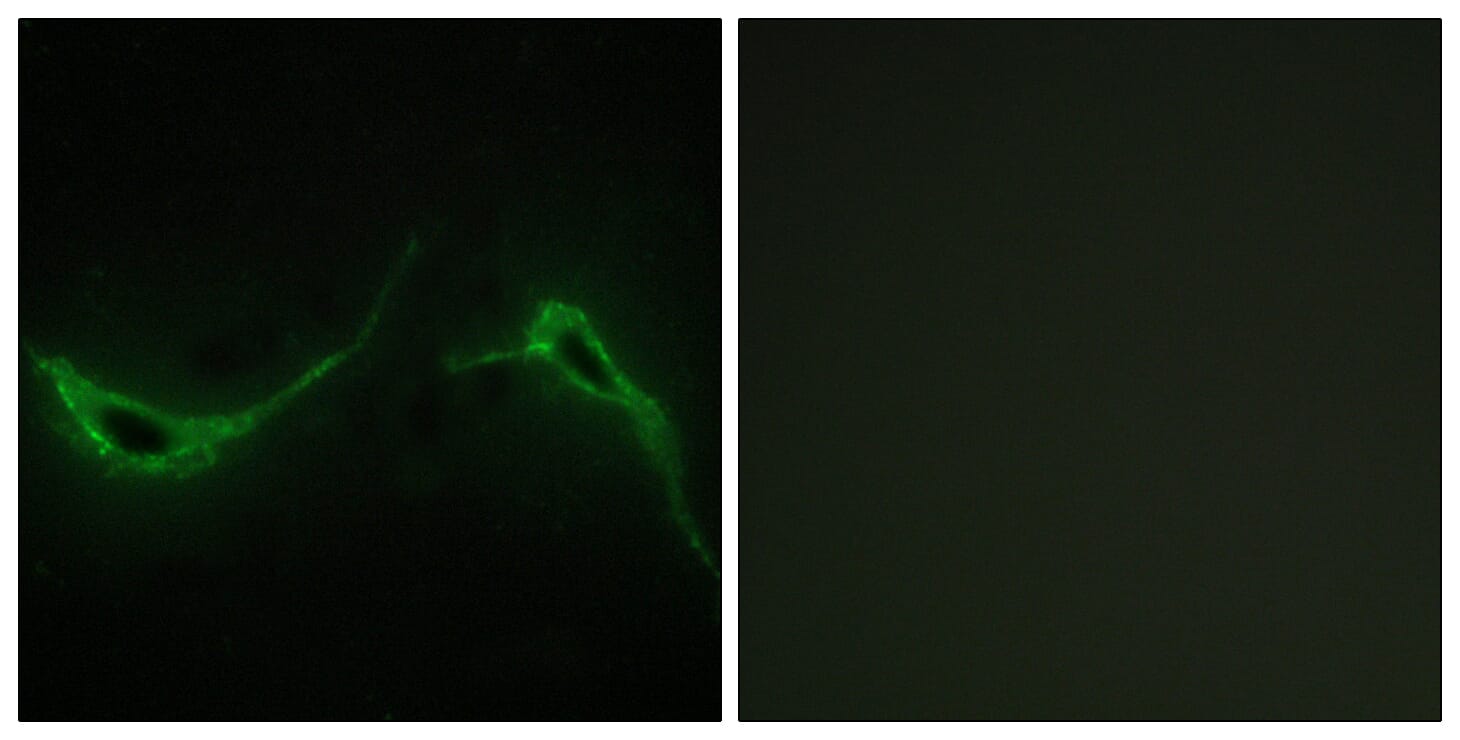 Immunofluorescence analysis of NIH/3T3 cells using Anti-ADCY7 Antibody. The right hand panel represents a negative control, where the antibody was pre-incubated with the immunising peptide.