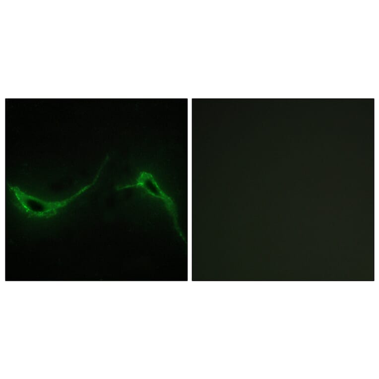 Immunofluorescence - Anti-ADCY7 Antibody (C12037) - Antibodies.com