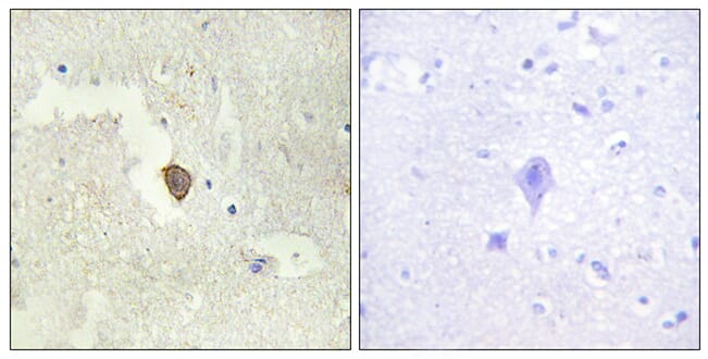 Immunohistochemical analysis of paraffin-embedded human brain tissue using Anti-ADCY7 Antibody. The right hand panel represents a negative control, where the antibody was pre-incubated with the immunising peptide.