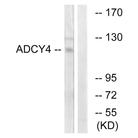 Western Blot - Anti-ADCY4 Antibody (C12034) - Antibodies.com