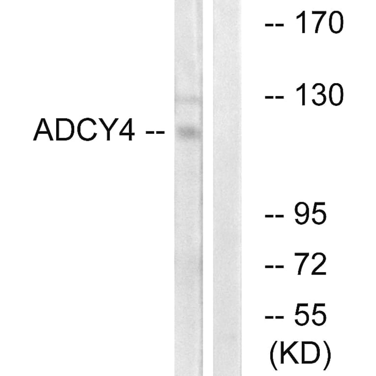 Western Blot - Anti-ADCY4 Antibody (C12034) - Antibodies.com