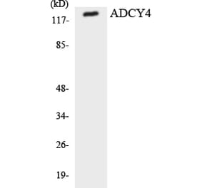 Western Blot - Anti-ADCY4 Antibody (R12-2447) - Antibodies.com