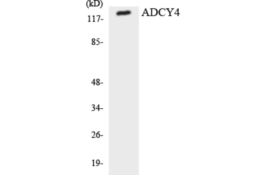 Western Blot - Anti-ADCY4 Antibody (R12-2447) - Antibodies.com
