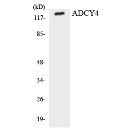 Western Blot - Anti-ADCY4 Antibody (R12-2447) - Antibodies.com