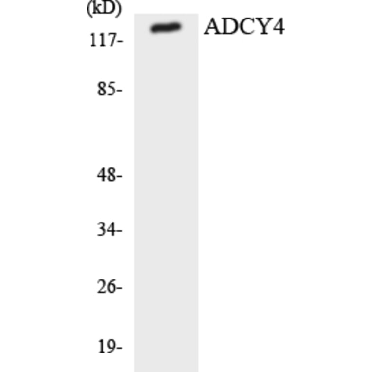 Western Blot - Anti-ADCY4 Antibody (R12-2447) - Antibodies.com