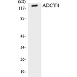 Western Blot - Anti-ADCY4 Antibody (R12-2447) - Antibodies.com