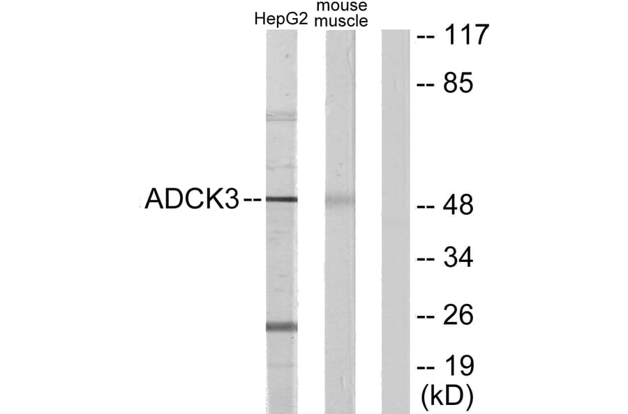 Western Blot - Anti-ADCK3 Antibody (C11378) - Antibodies.com