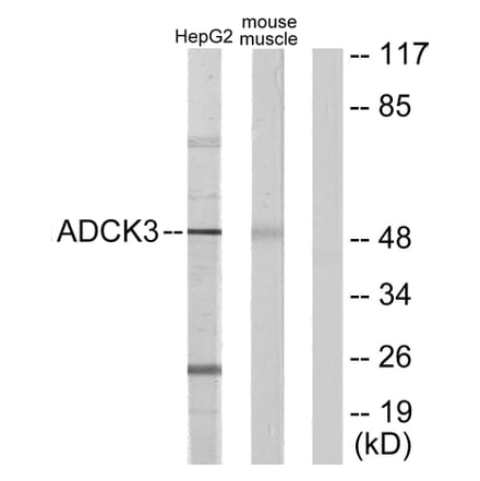 Western Blot - Anti-ADCK3 Antibody (C11378) - Antibodies.com