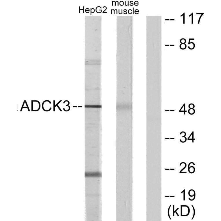 Western Blot - Anti-ADCK3 Antibody (C11378) - Antibodies.com