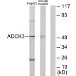 Western Blot - Anti-ADCK3 Antibody (C11378) - Antibodies.com
