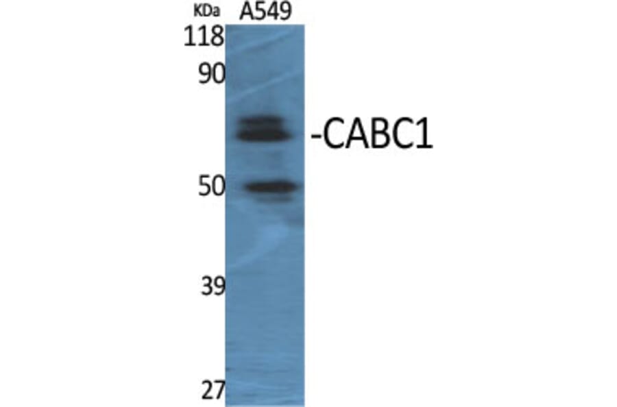 Western Blot - Anti-ADCK3 Antibody (C11378) - Antibodies.com