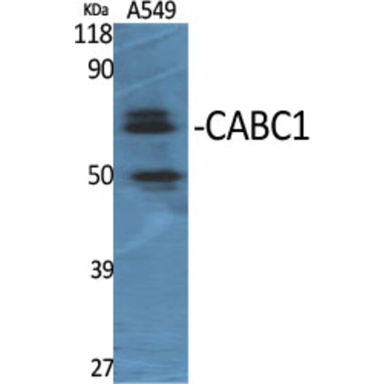 Western Blot - Anti-ADCK3 Antibody (C11378) - Antibodies.com