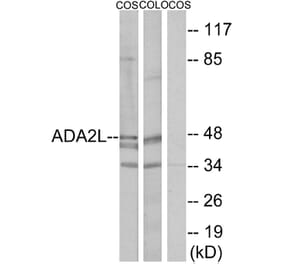 Western Blot - Anti-ADA2L Antibody (C10181) - Antibodies.com