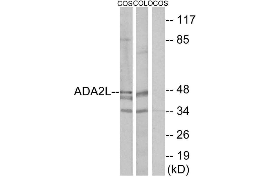 Western Blot - Anti-ADA2L Antibody (C10181) - Antibodies.com