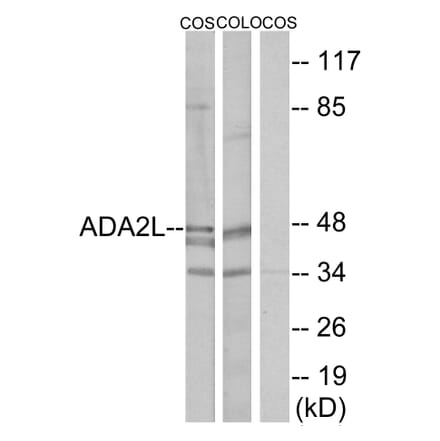 Western Blot - Anti-ADA2L Antibody (C10181) - Antibodies.com