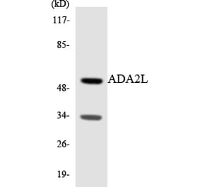 Western Blot - Anti-ADA2L Antibody (R12-2444) - Antibodies.com