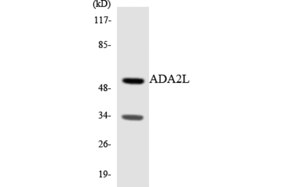 Western Blot - Anti-ADA2L Antibody (R12-2444) - Antibodies.com