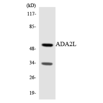 Western Blot - Anti-ADA2L Antibody (R12-2444) - Antibodies.com