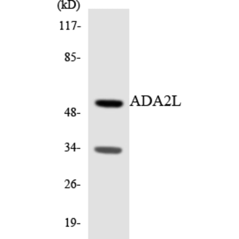 Western Blot - Anti-ADA2L Antibody (R12-2444) - Antibodies.com