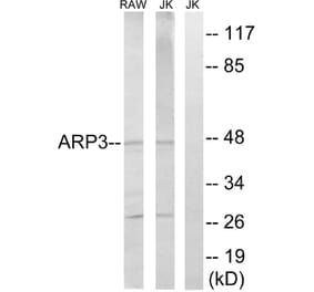 Western Blot - Anti-ACTR3 Antibody (C14244) - Antibodies.com