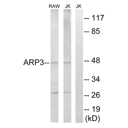Western Blot - Anti-ACTR3 Antibody (C14244) - Antibodies.com