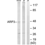 Western Blot - Anti-ACTR3 Antibody (C14244) - Antibodies.com