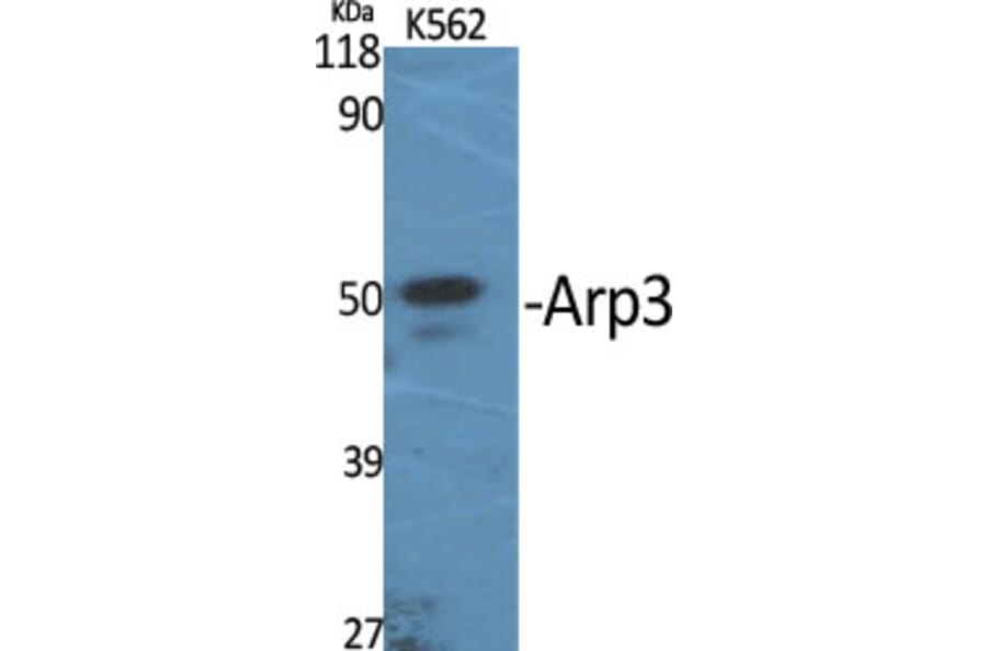 Western Blot - Anti-ACTR3 Antibody (C14244) - Antibodies.com