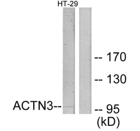 Western Blot - Anti-ACTN3 Antibody (C12026) - Antibodies.com