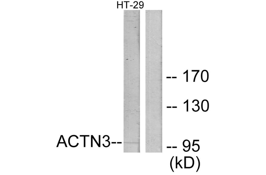 Western Blot - Anti-ACTN3 Antibody (C12026) - Antibodies.com
