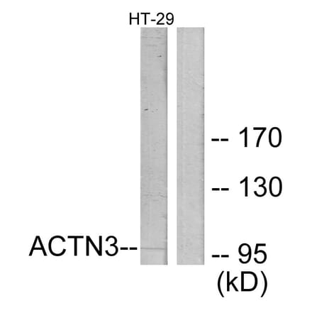 Western Blot - Anti-ACTN3 Antibody (C12026) - Antibodies.com