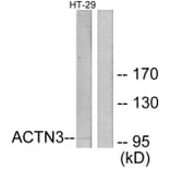Western Blot - Anti-ACTN3 Antibody (C12026) - Antibodies.com