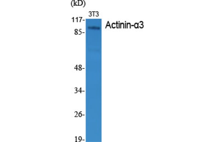 Western Blot - Anti-ACTN3 Antibody (C12026) - Antibodies.com