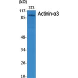 Western Blot - Anti-ACTN3 Antibody (C12026) - Antibodies.com