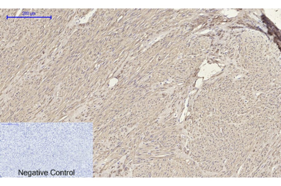 Immunohistochemistry - Anti-ACTA2 Antibody (C30880) - Antibodies.com