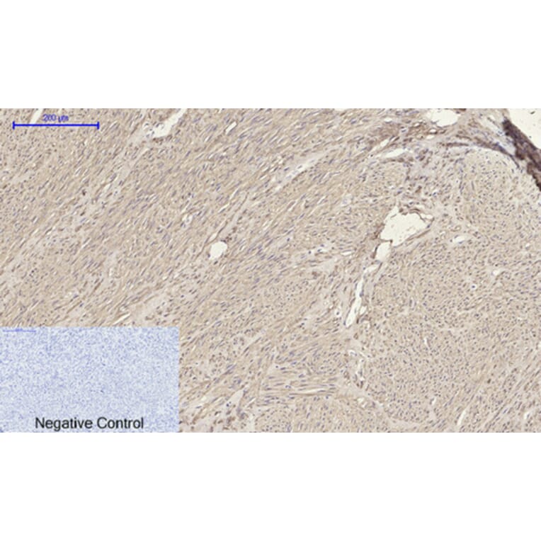 Immunohistochemistry - Anti-ACTA2 Antibody (C30880) - Antibodies.com