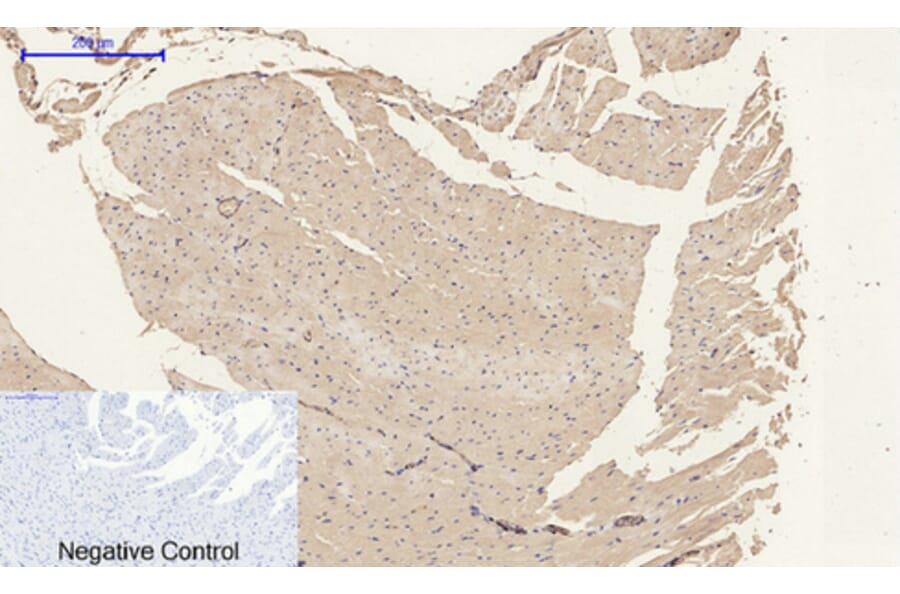 Immunohistochemistry - Anti-ACTA2 Antibody (C30880) - Antibodies.com