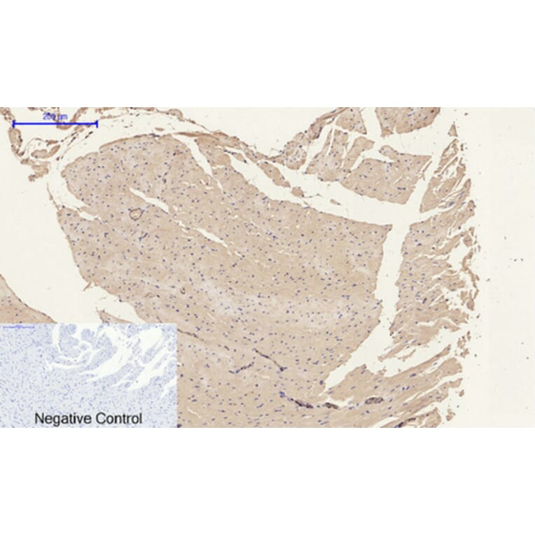 Immunohistochemistry - Anti-ACTA2 Antibody (C30880) - Antibodies.com