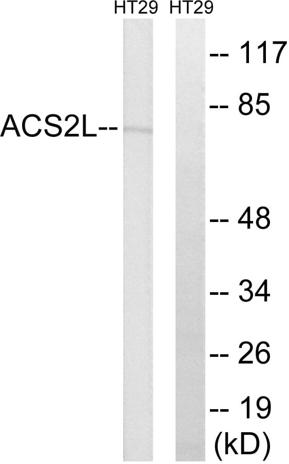 Western blot analysis of lysates from HT-29 cells using Anti-ACSS1 Antibody. The right hand lane represents a negative control, where the antibody is blocked by the immunising peptide.