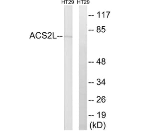 Western Blot - Anti-ACSS1 Antibody (C14234) - Antibodies.com