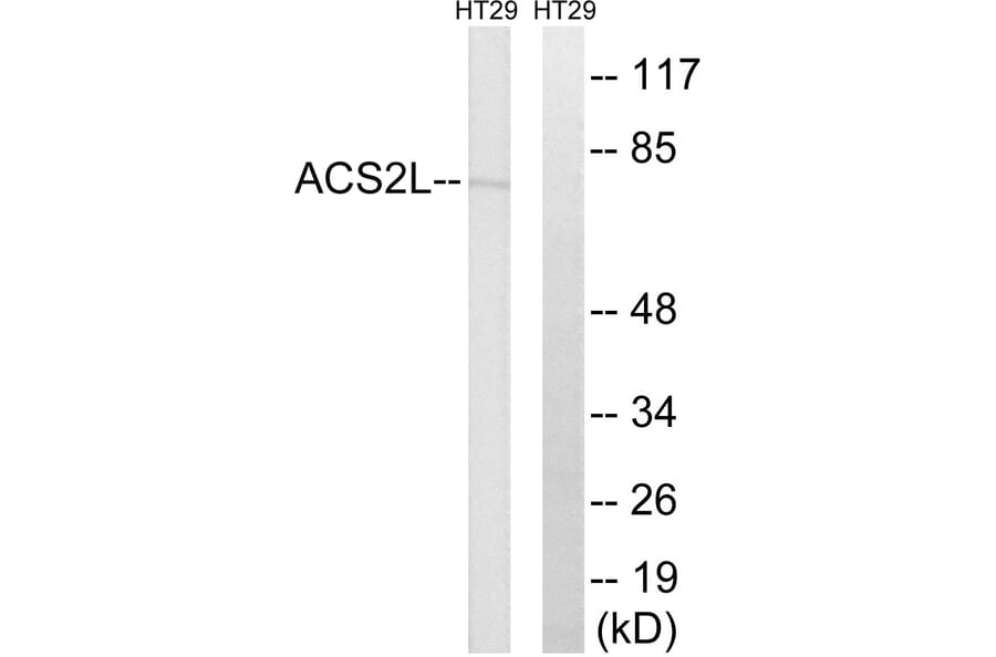 Western Blot - Anti-ACSS1 Antibody (C14234) - Antibodies.com
