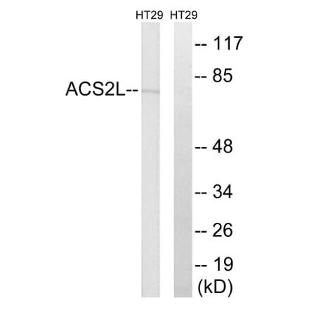 Western Blot - Anti-ACSS1 Antibody (C14234) - Antibodies.com