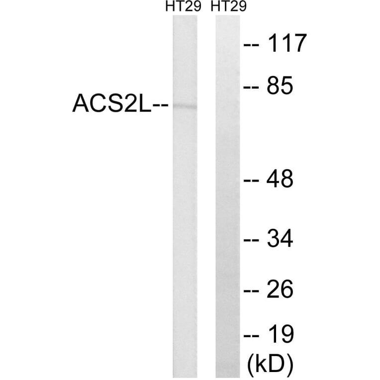 Western Blot - Anti-ACSS1 Antibody (C14234) - Antibodies.com