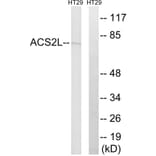 Western Blot - Anti-ACSS1 Antibody (C14234) - Antibodies.com