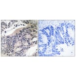 Immunohistochemistry - Anti-ACSS1 Antibody (C14234) - Antibodies.com