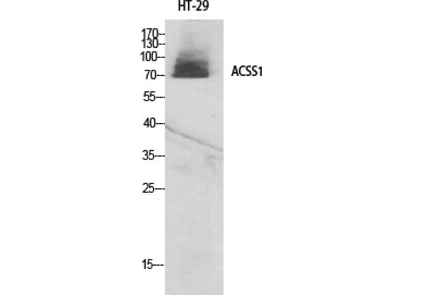 Western Blot - Anti-ACSS1 Antibody (C14234) - Antibodies.com