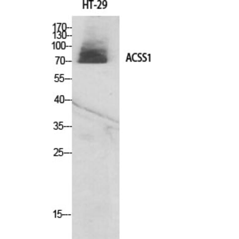Western Blot - Anti-ACSS1 Antibody (C14234) - Antibodies.com