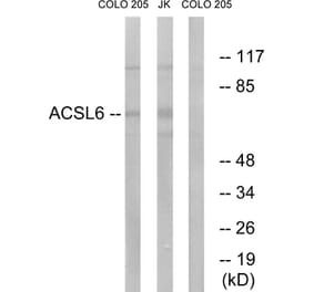 Western Blot - Anti-ACSL6 Antibody (C16495) - Antibodies.com